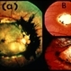 Macular Coloboma